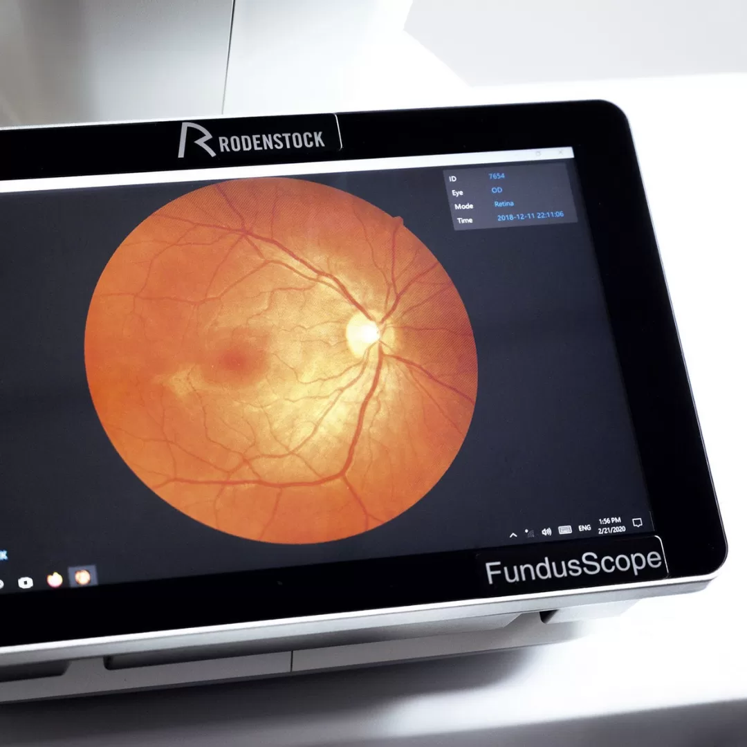 Imagem ilustrativa do exame de retinografia na Central Ópticas