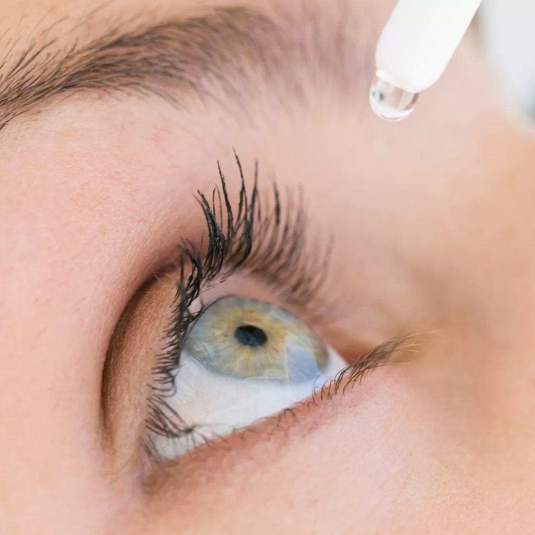 Aplicação de gotas oculares para alívio do olho seco