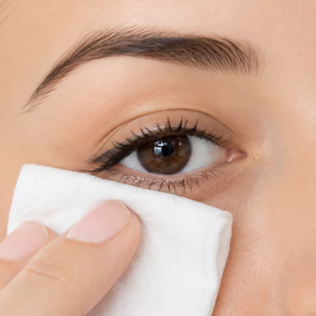 Pessoa a limpar a pálpebra com uma toalhita de higiene ocular