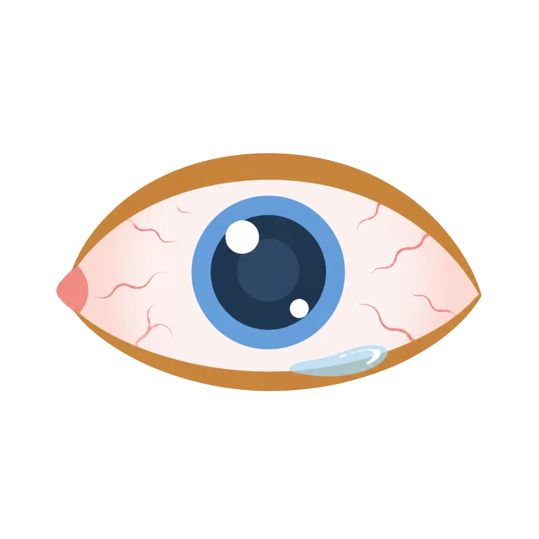 Ilustração de um olho vermelho e irritado, representando olhos sensíveis