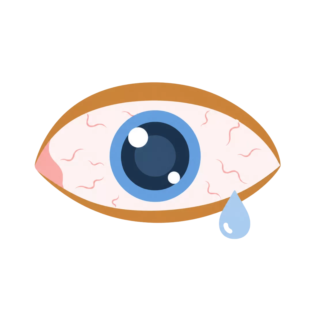 Ilustração de um olho vermelho com uma lágrima, representando desconforto ocular